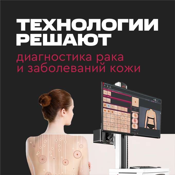 FotoFinder